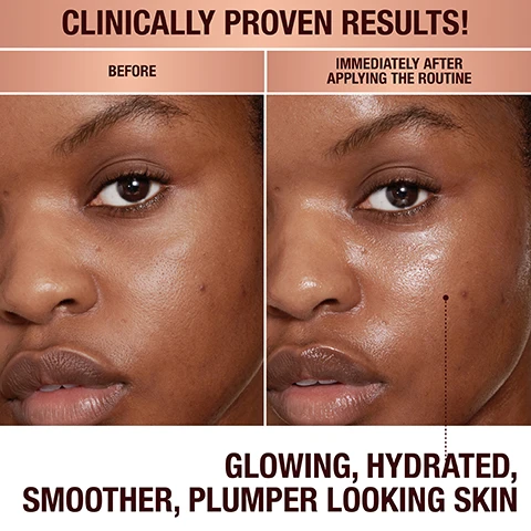 Image 1 - A side-by-side comparison image showing the face of a person before and immediately after applying a skincare routine, emphasizing differences in skin appearance, with visible text stating CLINICALLY PROVEN RESULTS! above and GLOWING, HYDRATED, SMOOTHER, PLUMPER LOOKING SKIN below.
Image 2 - A side-by-side comparison of a womans face showing a before image on the left with dull skin and an immediately after applying the routine image on the right with glowing and hydrated skin, accompanied by the text CLINICALLY PROVEN RESULTS! and GLOWING, HYDRATED, SMOOTHER, PLUMPER LOOKING SKIN.
Image 3 - Image shows a step-by-step skincare routine arranged on a pink background, featuring four products: Glow Toner labeled with Pores appear reduced by 41*, Charlottes Magic Serum Crystal Elixir labeled In just 1 hour, skin is 2x more hydrated, Magic Eye Rescue labeled Dark circles appear reduced by 3x, and Charlottes Magic Cream labeled Skin appears 2x firmer.
Image 4 - A hand with manicured nails displays four skincare products on the wrist in gel and cream forms, labeled as Step 1: Tone - Glow Toner, Step 2: Target - Charlottes Magic Serum Crystal Elixir, Step 3: Brighten - Magic Eye Rescue, and Step 4: Moisturise - Charlottes Magic Cream.
Image 5 - Image features four skincare products with white-background textures, labeled as Glow Toner, Charlottes Magic Serum Crystal Elixir, Magic Eye Rescue, and Charlottes Magic Cream; at the bottom, there is text that reads Darlings, I never do makeup without them! - Charlotte Tilbury MBE.