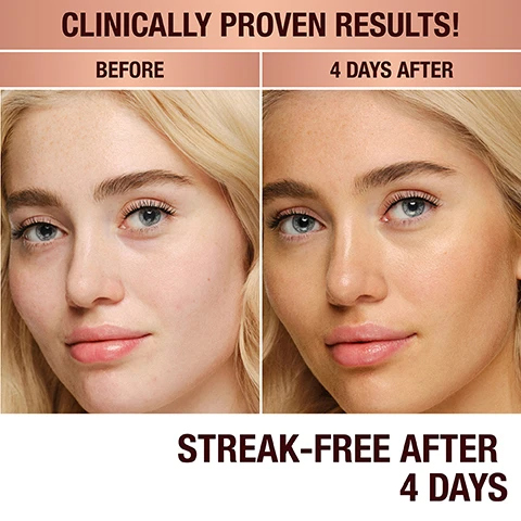 Image 1 - Side-by-side comparison of a young woman’s face before and four days after using a skincare product, with visible text stating CLINICALLY PROVEN RESULTS!, BEFORE, 4 DAYS AFTER, and STREAK-FREE AFTER 4 DAYS.
Image 2 - Two bottles of tanning drops labeled Island Glow on a sandy surface with water; text reads CHOOSE FROM TWO SUN-KISSED SHADES!, TAN/DEEP FOR WARMER/NEUTRAL UNDERTONES, and LIGHT/MEDIUM FOR COOLER/NEUTRAL UNDERTONES.