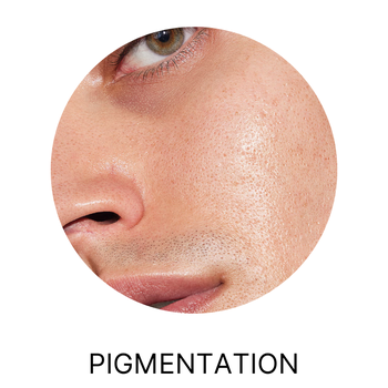 Pigmentation